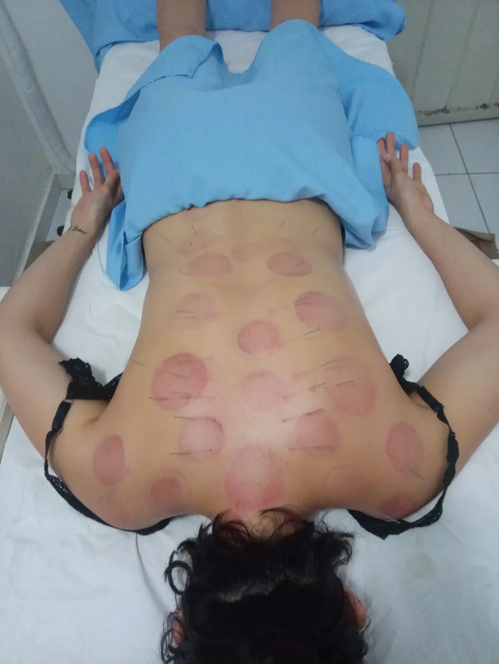 Fernanda Fernandes Acupuntura