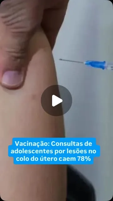 Vacinação contra HPV reduz lesões pré-cancerígenas em 78%