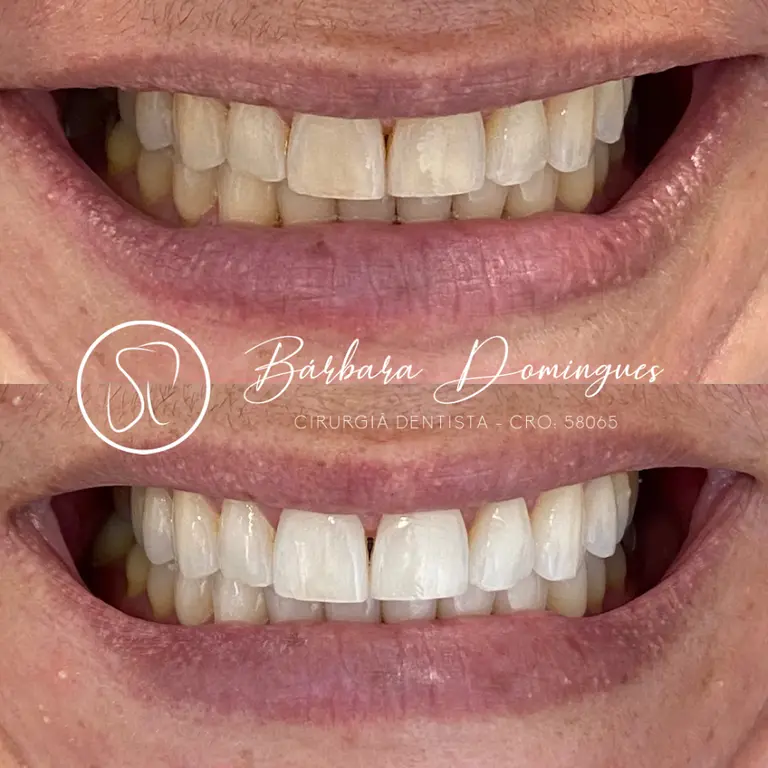Consultório Odontológico Bárbara Domingues | ESTÉTICA | SAÚDE | BEM-ESTAR