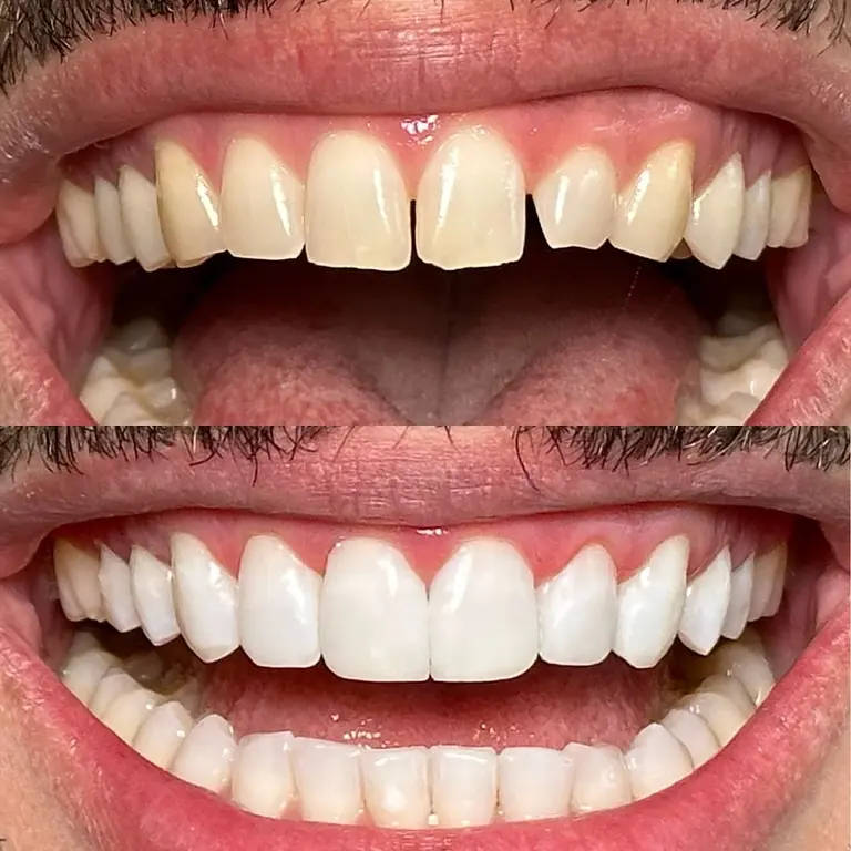 Dr. Lucas Rodrigues Odontologia Estética