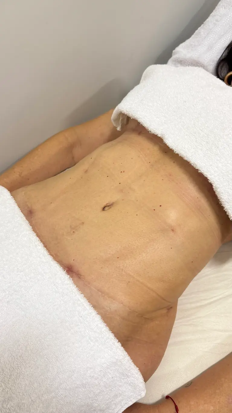Dra Raiane Luisa - Fisioterapeuta Especializada