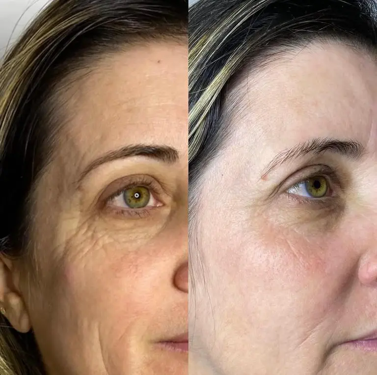 Vitória Sodré Estética