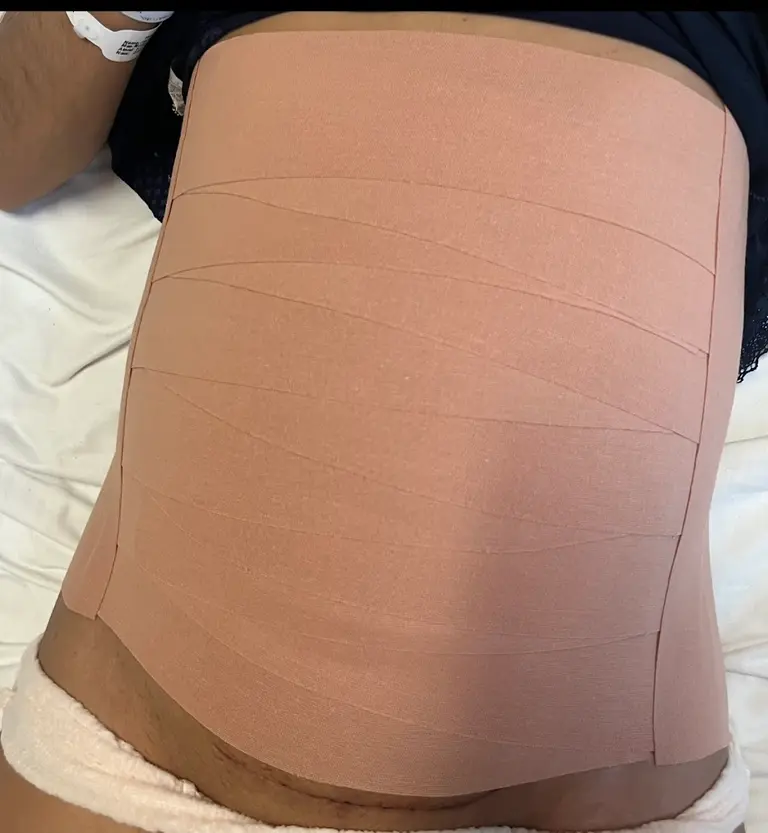 Isabela Proença fisioterapia pélvica