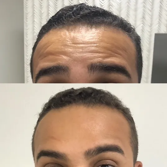 Dra. Bárbara Brandão -Harmonização Facial