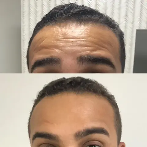 Dra. Bárbara Brandão -Harmonização Facial
