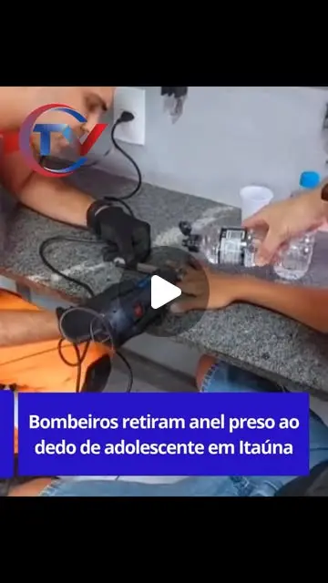 Bombeiros retiram anel preso no dedo de adolescente