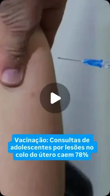 Vacinação contra HPV reduz lesões pré-cancerígenas em 78%